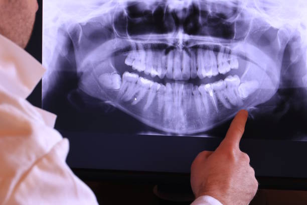 Best Emergency Treatment for Toothache in Ridgefield, WA